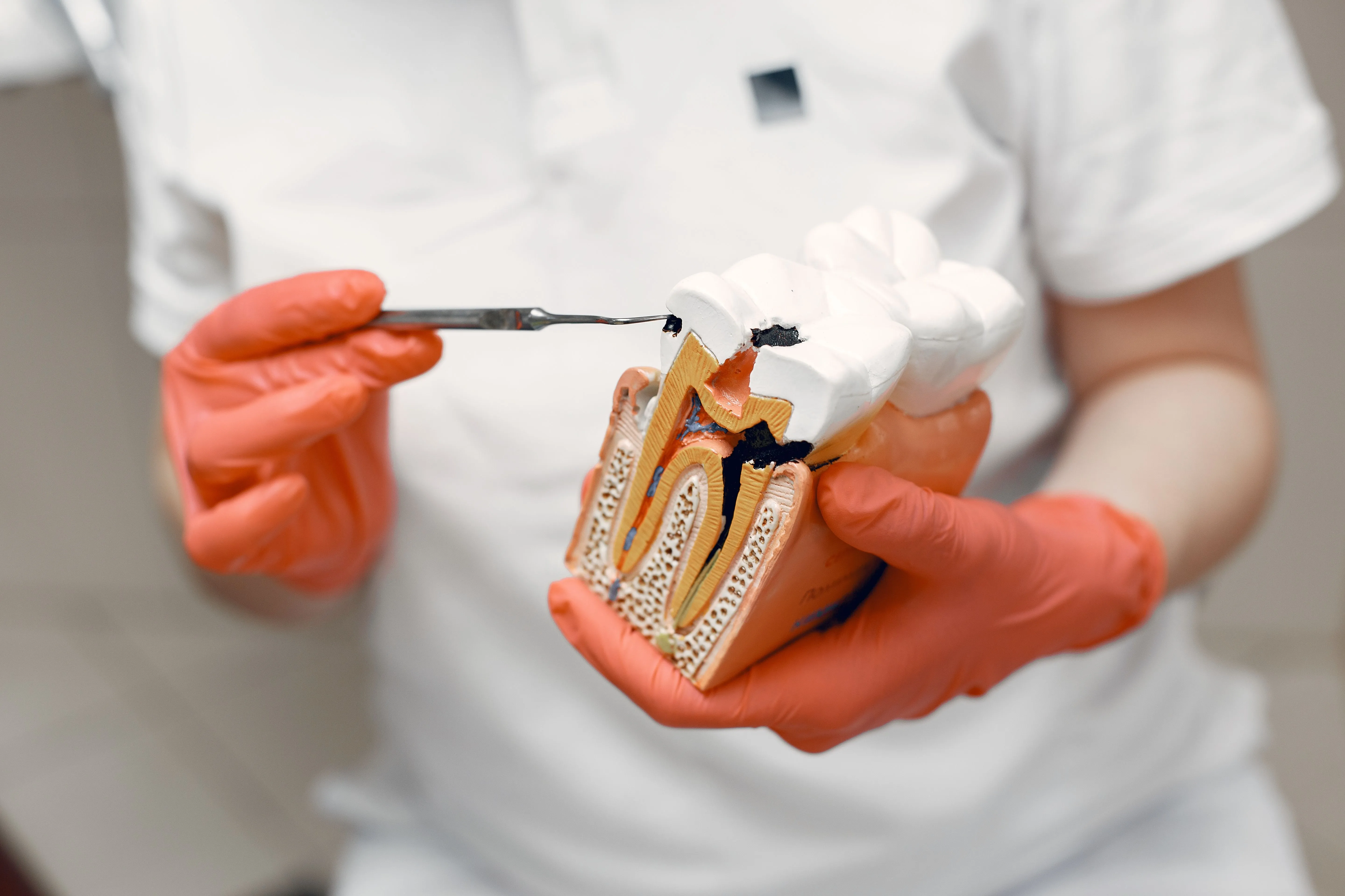 Root canal treatment cost guide in Lucknow at Brite Smile Dental Care